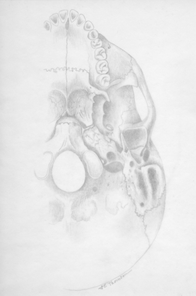 Adult skull