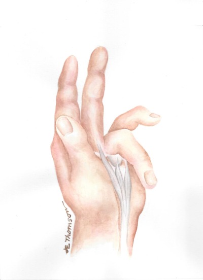 Dupuyten's Contracture, Before Exercises