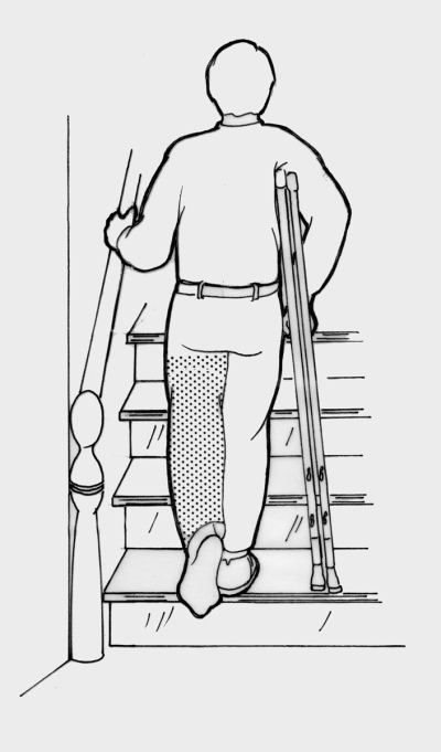 Patient ascending stairs