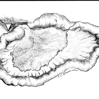 Repair intestinal atresia