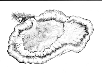 Repair intestinal atresia